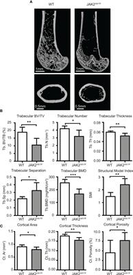 Inhibition of Osteoblast Differentiation by JAK2V617F Megakaryocytes Derived From Male Mice With Primary Myelofibrosis